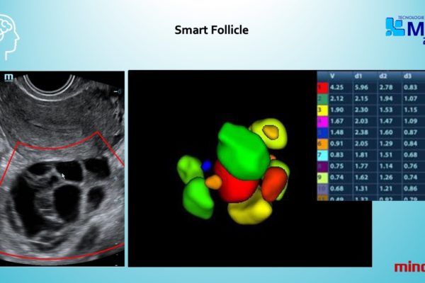 Diapositiva11