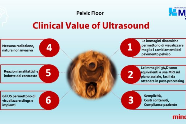 Diapositiva14