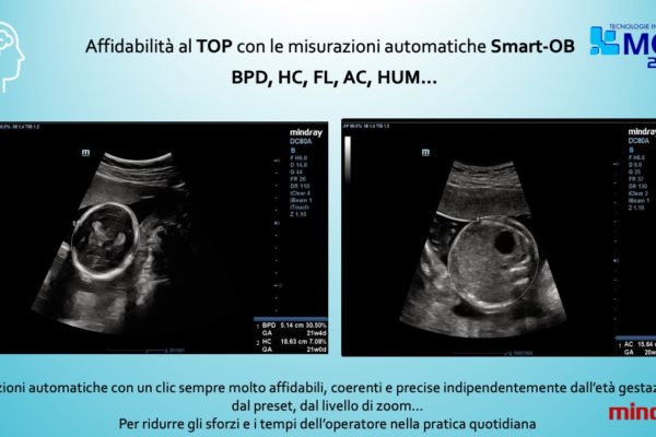 Diapositiva4