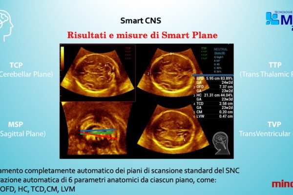 Diapositiva7