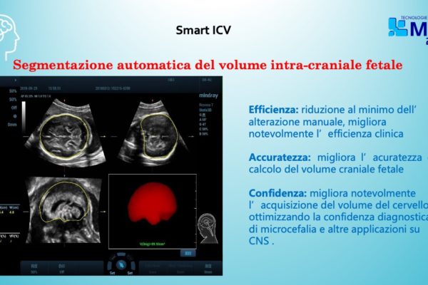 Diapositiva8